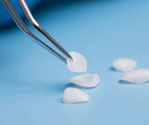 Tweezers picking up a veneer